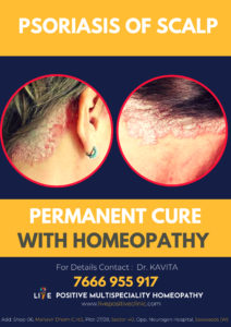 "psoriasis treatment in homeopathy"